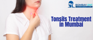 Top Tonsils Specialists in Mumbai Finding the Right Doctor for Your Treatment