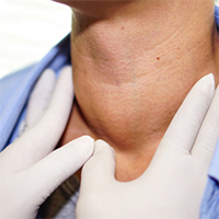 thyroid-swelling